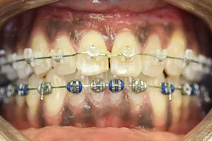 Smile photo