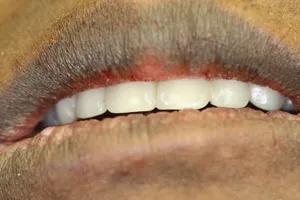 Smile photo