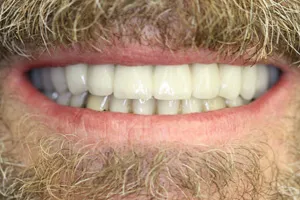 Smile photo