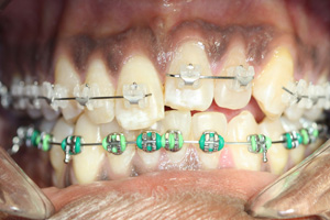 smile photo