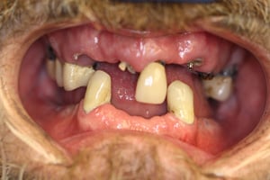 smile photo